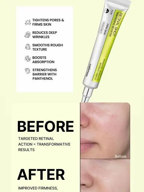 Celimax Retinal Shot before and after skin results showing pore tightening and wrinkle reduction.